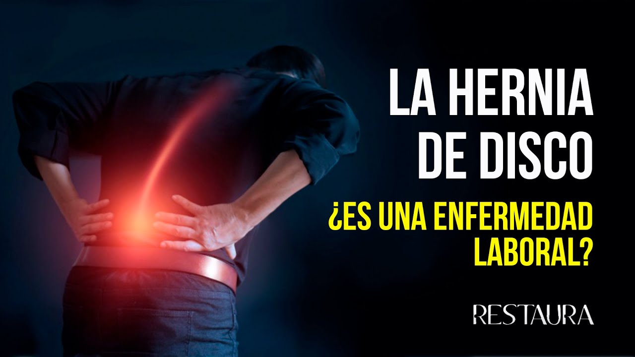 ¿Cuándo se puede considerar una hernia discal como enfermedad profesional?